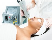 Лазерный пилинг кожи лица в кабинете лазерной хирургии "LaserMedMoldova" Кишинев, Молдова!