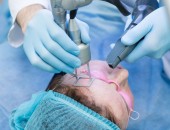 Лазерный Плазмолифтинг в Молдове! Laser Skin Resurfacing + Platelet-rich plasma (PRP) therapy