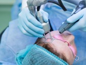 Tratamentele cu laser fractional in combinatie cu terapia PRP in cabinetul de chirurgue “LaserMedMoldova”!