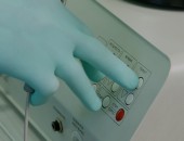 Лазерное лечение оникомикоза грибок ногтей в Кишиневе, Молдове!