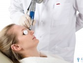 CO2 laser skin resurfacing in combinatie cu terapia PRP (Platelet Rich Plasma) - „MINUS 20%”!