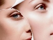 Intinerirea tenului printr-o procedura noninvaziva si eficienta cu laser la nivelul fetei în volum 2D și 3D in cabinetul de chirurgie laser LaserMedMoldova!