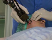 Tratament cu laser a petelor pigmentare in Moldova!