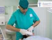 Tratamentele cu laser CO2 fractional in combinatie cu terapia PRP in Moldova!
